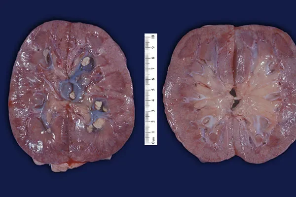 A medical paradigm shattered: UCLA study...