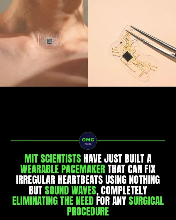 May be an image of text that says 'OMG [facts MIT SCIENTISTS HAVE JUST BUILT A WEARABLE PACEMAKER THAT CAN FIX IRREGULAR HEARTBEATS USING NOTHING BUT SOUND WAVES, COMPLETELY ELIMINATING THE NEED FOR ANY SURGICAL PROCEDURE'